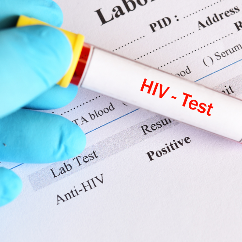 HIV 4th Gen Test