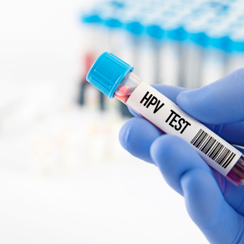 HPV Test (Female)