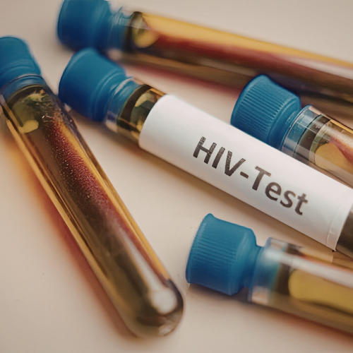 HIV Confirmatory Test