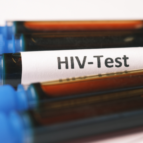HIV 1 & 2 Early Detection